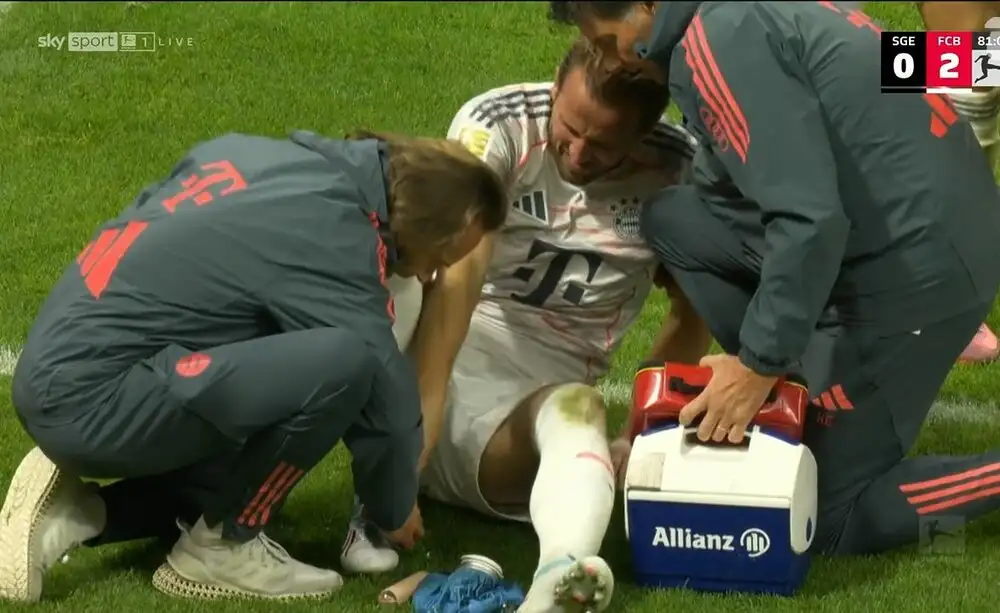 Rival’s delight as Harry Kane limps off after ankle blow; Bayern’s momentum rattled