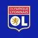 Endrick to Lyon edges closer as 25-game clause signals a development-first loan